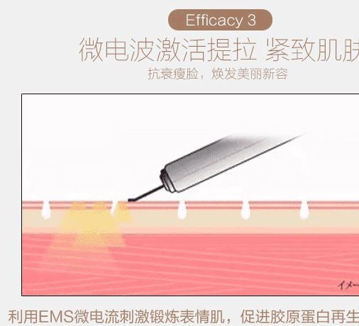 超聲波祛黑頭祛皮機 美容院家用超聲波鏟皮刀 皮膚深層清潔鏟皮機示例圖12