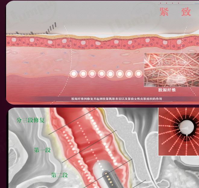 私密超聲刀家用美容儀器美容院女性超聲波緊致修復(fù)護(hù)理儀示例圖10