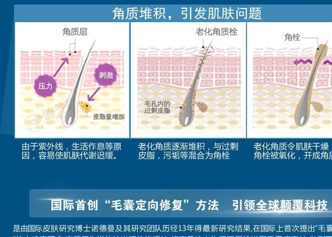 力医净 去鸡皮肤身体乳美白霜鸡皮疙瘩鱼鳞毛囊炎毛周角化症角质示例图5