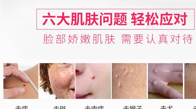 新款微型等離子點痣筆 祛斑 去痘筆美容筆多功能美容儀廠家直銷示例圖2